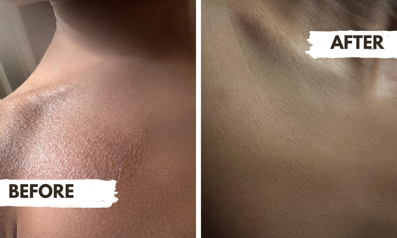 Gotu Kola and Witch Hazel Lotion
