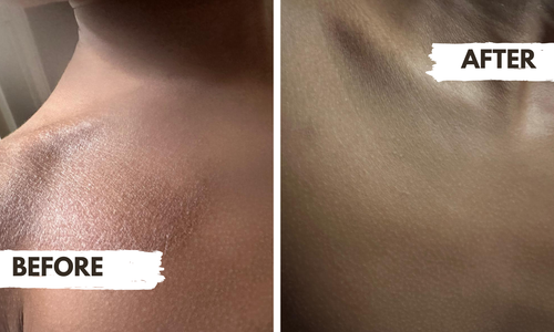 Gotu Kola and Witch Hazel Lotion